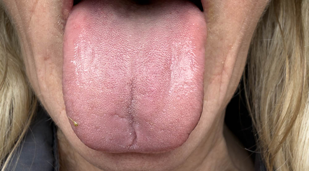 my tongue